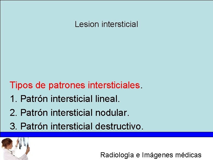 Lesion intersticial Tipos de patrones intersticiales. 1. Patrón intersticial lineal. 2. Patrón intersticial nodular.