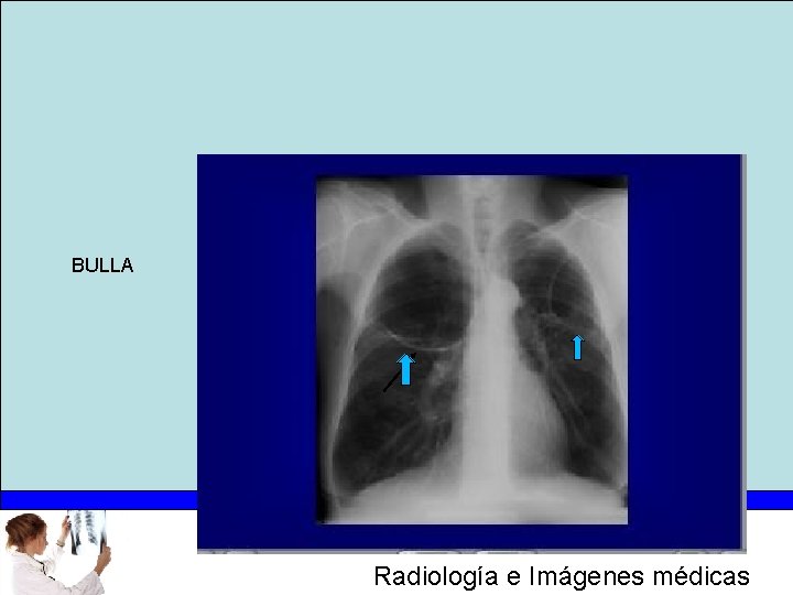 BULLA Radiología e Imágenes médicas 