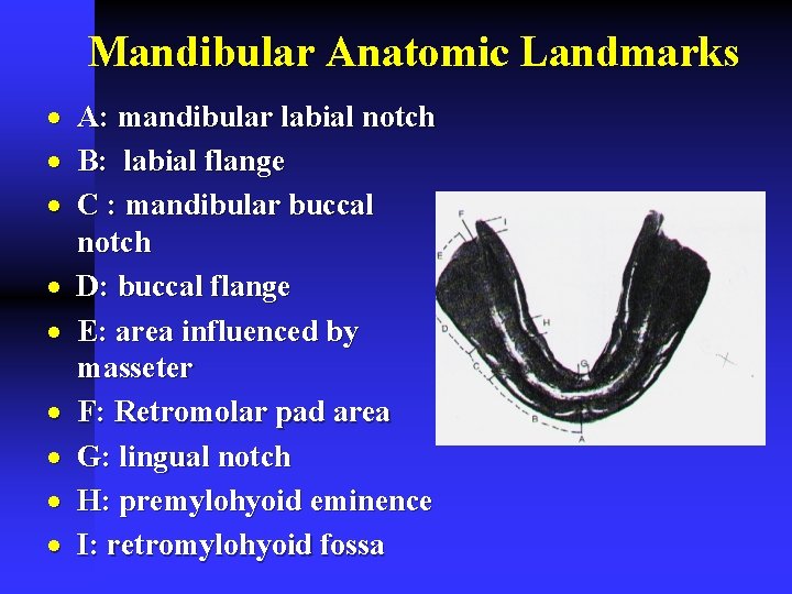 Mandibular Anatomic Landmarks · · · · · A: mandibular labial notch B: labial