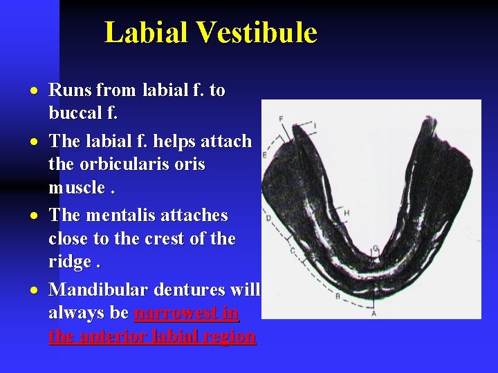 Labial Vestibule · Runs from labial f. to buccal f. · The labial f.