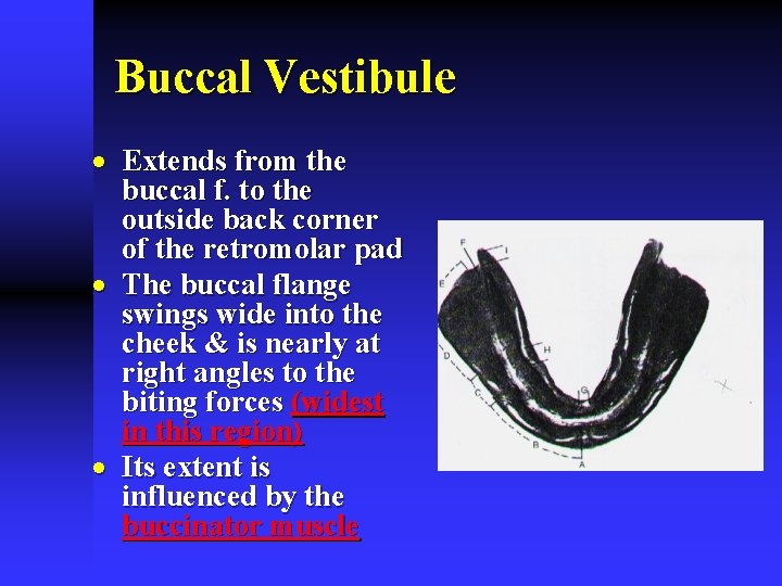 Buccal Vestibule · Extends from the buccal f. to the outside back corner of
