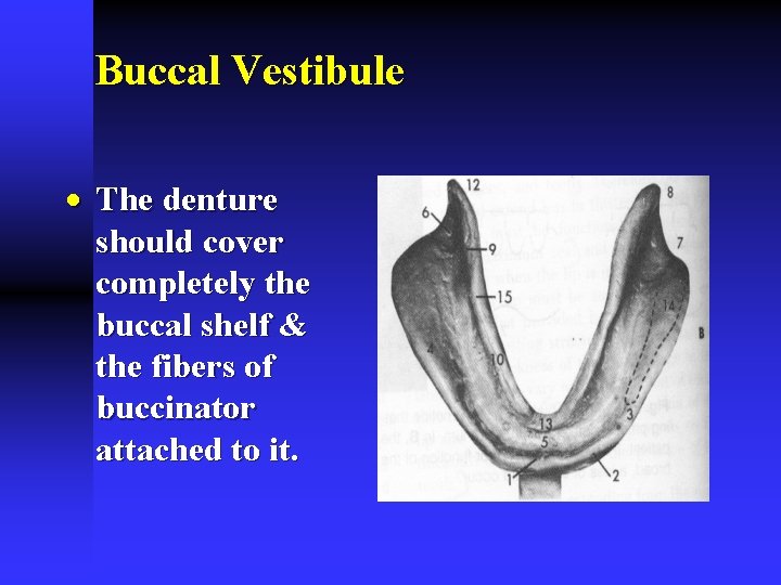 Buccal Vestibule · The denture should cover completely the buccal shelf & the fibers