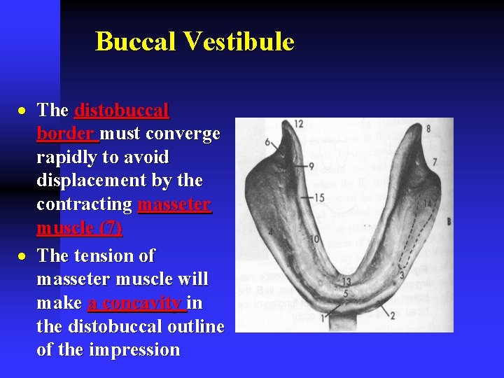 Buccal Vestibule · The distobuccal border must converge rapidly to avoid displacement by the