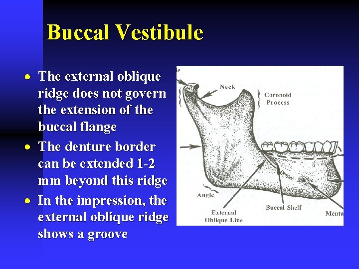 Buccal Vestibule · The external oblique ridge does not govern the extension of the