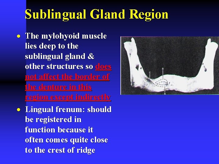 Sublingual Gland Region · The mylohyoid muscle lies deep to the sublingual gland &
