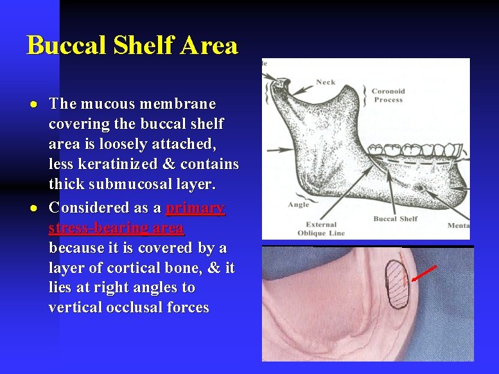 Buccal Shelf Area · The mucous membrane covering the buccal shelf area is loosely