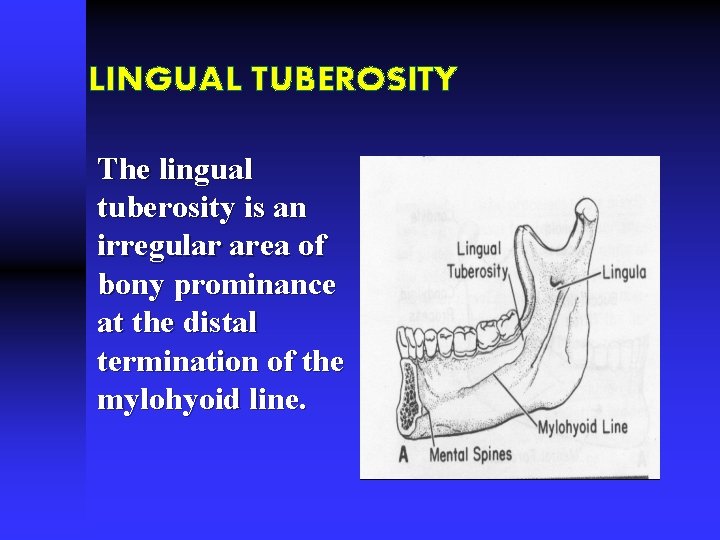 LINGUAL TUBEROSITY The lingual tuberosity is an irregular area of bony prominance at the
