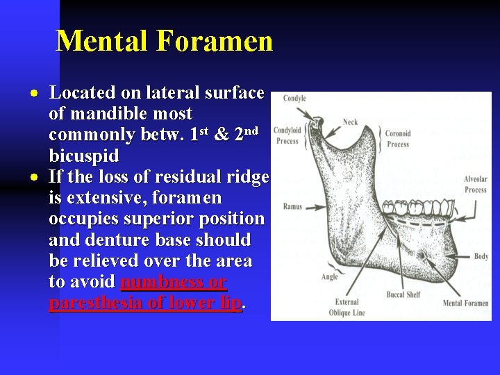 Mental Foramen · Located on lateral surface of mandible most commonly betw. 1 st