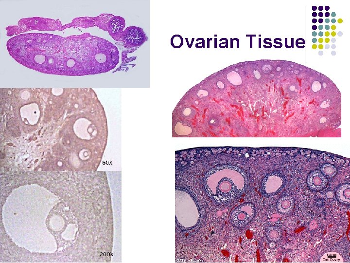 Ovarian Tissue 