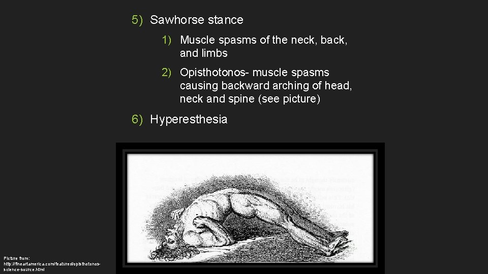 5) Sawhorse stance 1) Muscle spasms of the neck, back, and limbs 2) Opisthotonos-