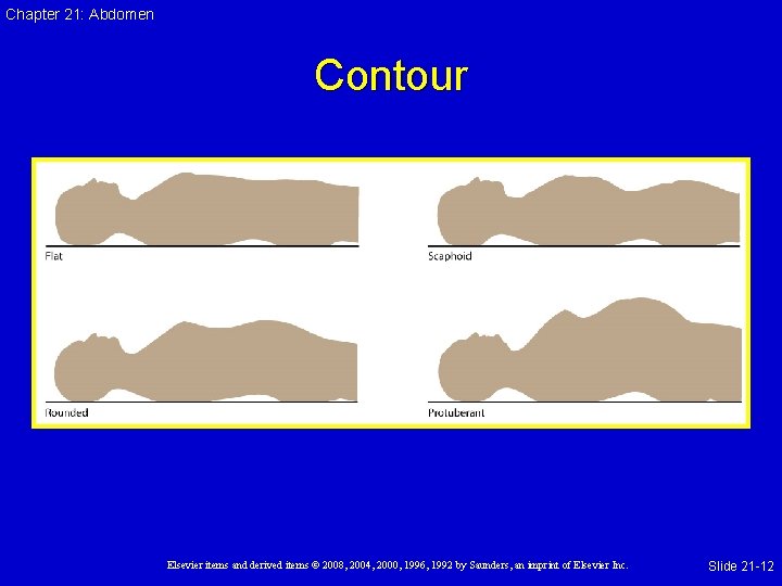 Chapter 21: Abdomen Contour Elsevier items and derived items © 2008, 2004, 2000, 1996,