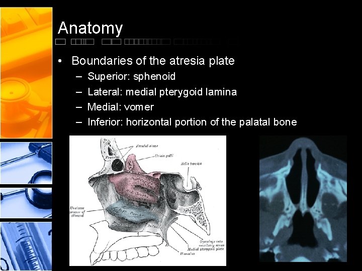 Anatomy • Boundaries of the atresia plate – – Superior: sphenoid Lateral: medial pterygoid