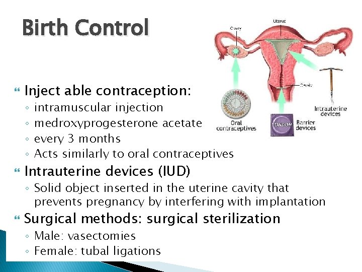 Birth Control Inject able contraception: ◦ ◦ intramuscular injection medroxyprogesterone acetate every 3 months