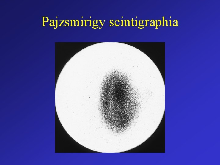 Pajzsmirigy scintigraphia 