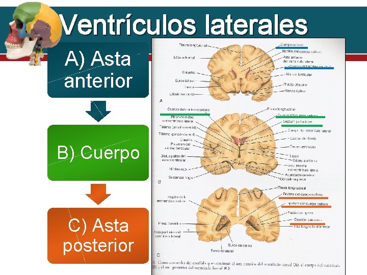 Ventrículos laterales A) Asta anterior B) Cuerpo C) Asta posterior 