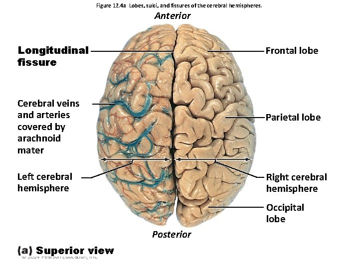 Figure 12. 4 a Lobes, sulci, and fissures of the cerebral hemispheres. Anterior Longitudinal