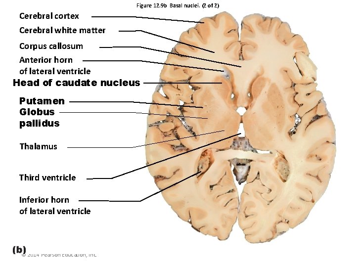 Figure 12. 9 b Basal nuclei. (2 of 2) Cerebral cortex Cerebral white matter