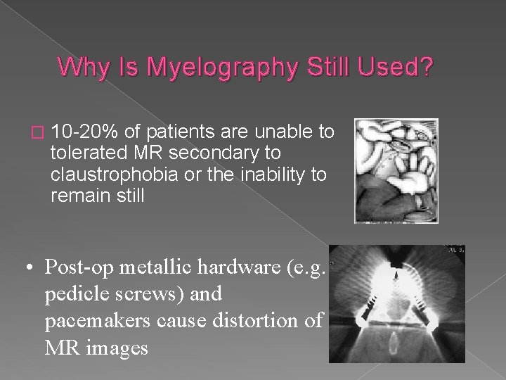 Why Is Myelography Still Used? � 10 -20% of patients are unable to tolerated