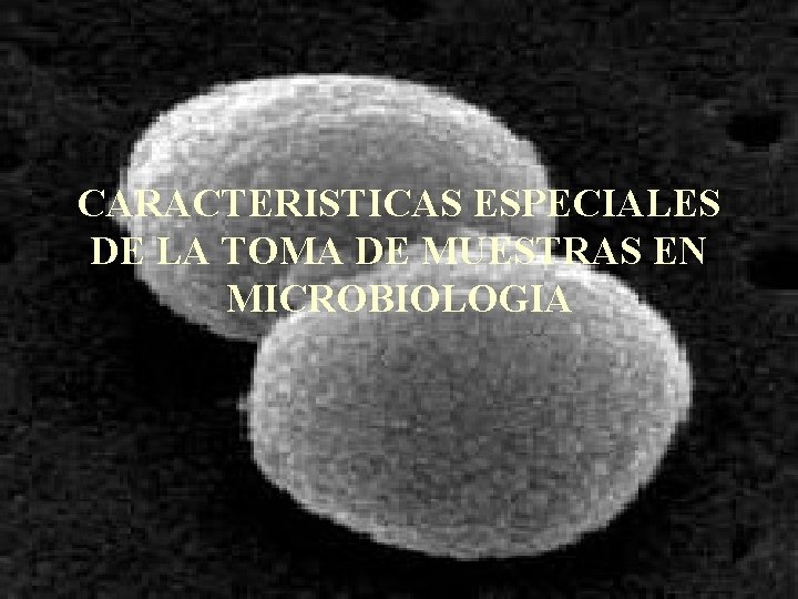 CARACTERISTICAS ESPECIALES DE LA TOMA DE MUESTRAS EN MICROBIOLOGIA 