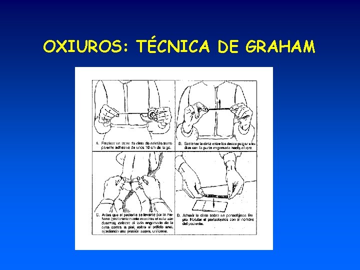 OXIUROS: TÉCNICA DE GRAHAM 