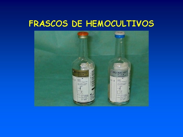 FRASCOS DE HEMOCULTIVOS 