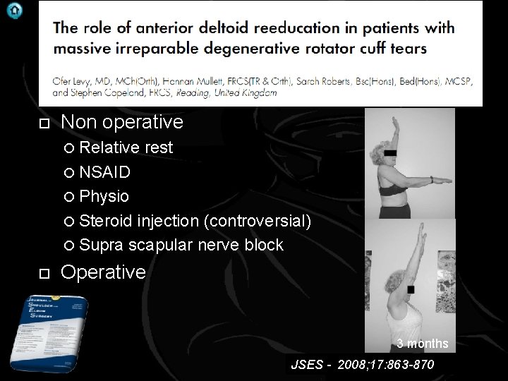 . Massive Rotator cuff tear Non operative Relative rest NSAID Physio Steroid injection (controversial)