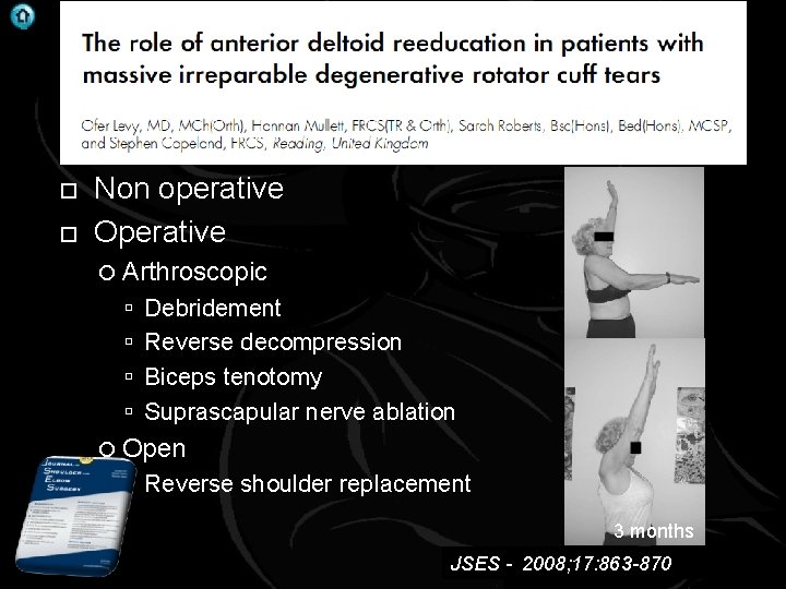 . Massive Rotator cuff tear Non operative Operative Arthroscopic Debridement Reverse decompression Biceps tenotomy