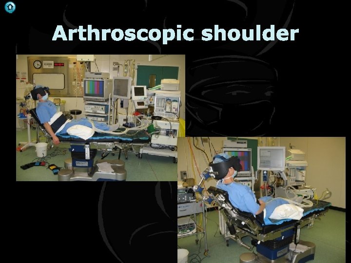 . Arthroscopic shoulder 