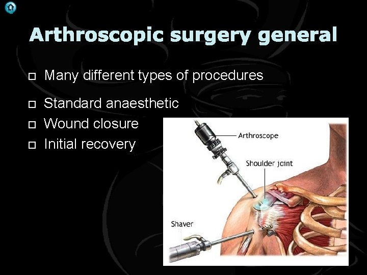 . Arthroscopic surgery general Many different types of procedures Standard anaesthetic Wound closure Initial