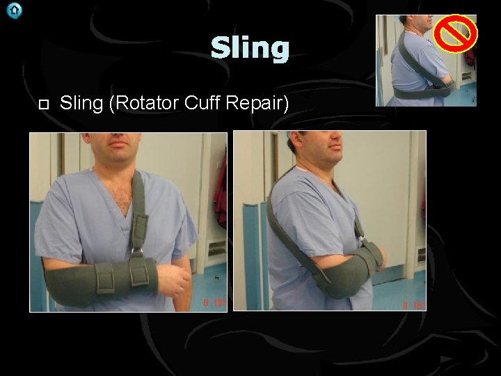 . Sling (Rotator Cuff Repair) 