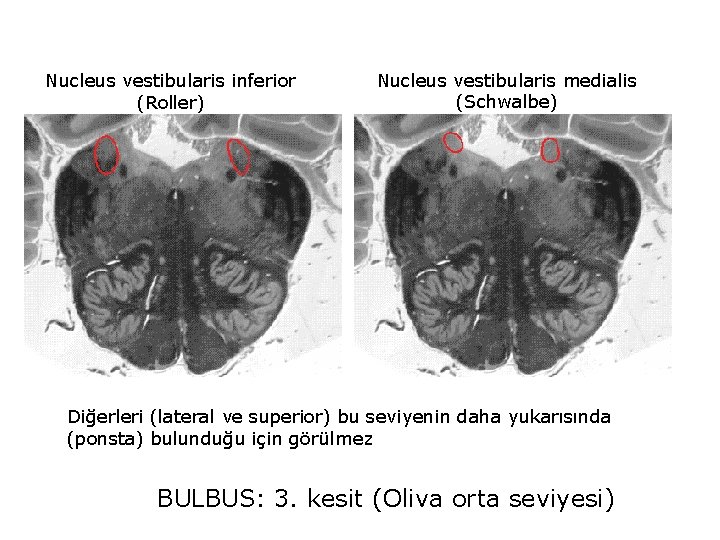 Nucleus vestibularis inferior (Roller) Nucleus vestibularis medialis (Schwalbe) Diğerleri (lateral ve superior) bu seviyenin