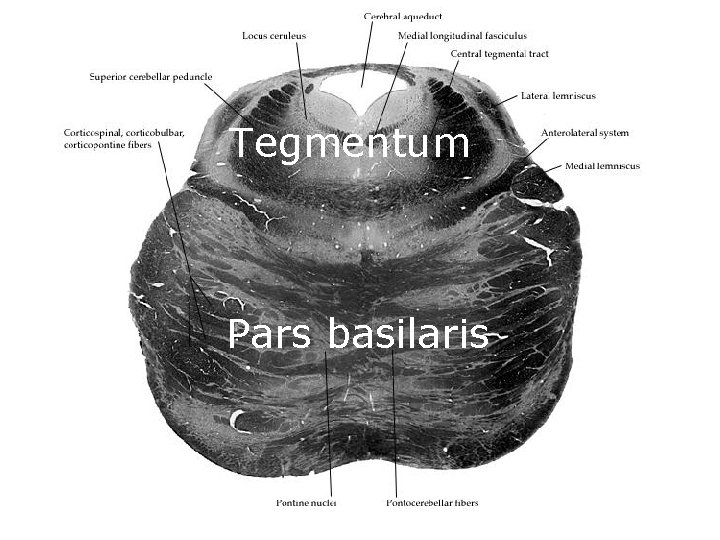 Tegmentum Pars basilaris 
