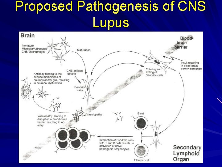 Proposed Pathogenesis of CNS Lupus 
