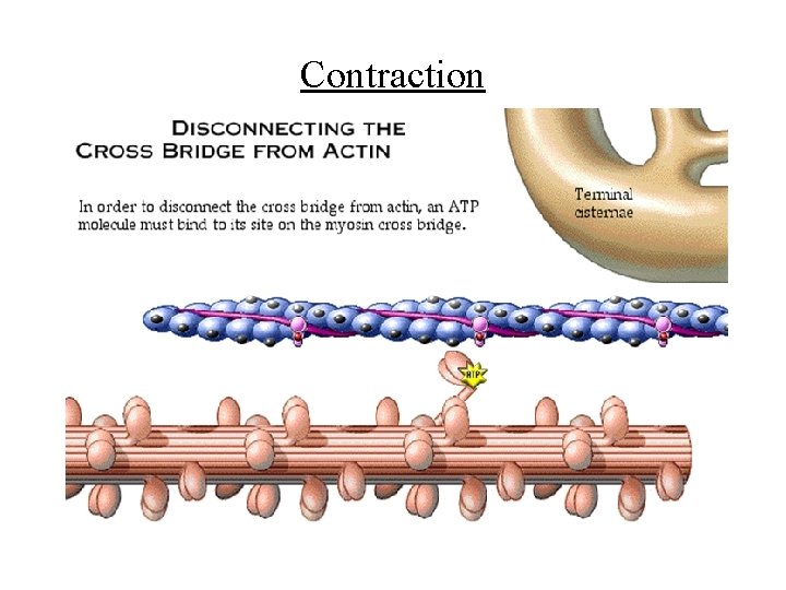 Contraction 