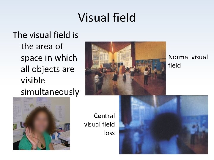 Visual field The visual field is the area of space in which all objects