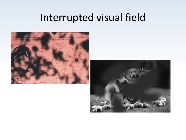 Interrupted visual field 