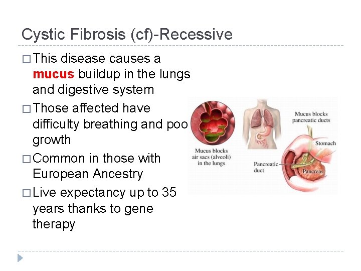 Cystic Fibrosis (cf)-Recessive � This disease causes a mucus buildup in the lungs and