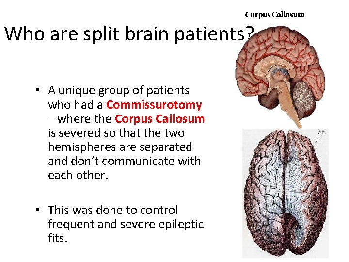 Who are split brain patients? • A unique group of patients who had a Who are split brain patients? • A unique group of patients who had a