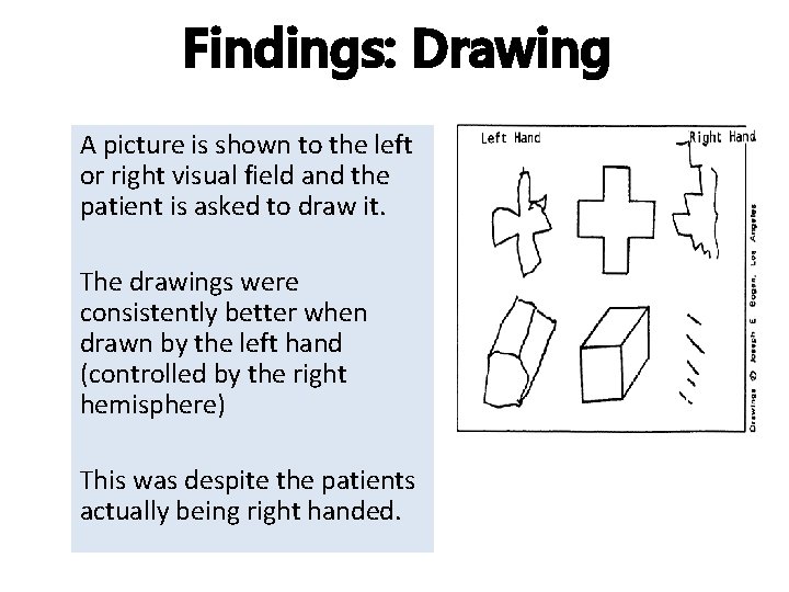 Findings: Drawing A picture is shown to the left or right visual field and Findings: Drawing A picture is shown to the left or right visual field and