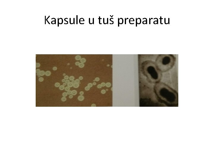 Kapsule u tuš preparatu 