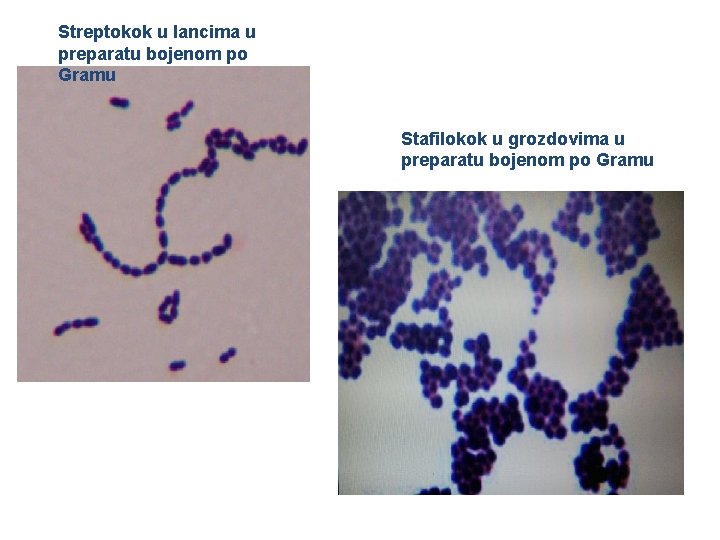 Streptokok u lancima u preparatu bojenom po Gramu Stafilokok u grozdovima u preparatu bojenom