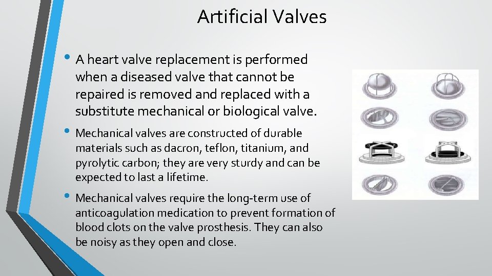 Artificial Valves • A heart valve replacement is performed when a diseased valve that