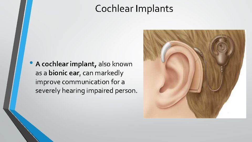 Cochlear Implants • A cochlear implant, also known as a bionic ear, can markedly