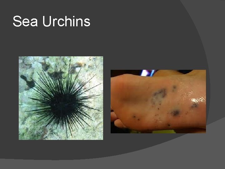 Sea Urchins 