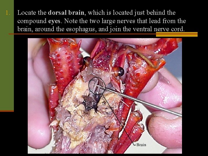 1. Locate the dorsal brain, which is located just behind the compound eyes. Note