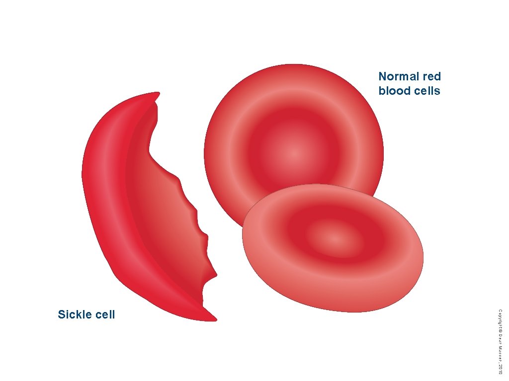 Normal red blood cells Copyright © Dean Madden, 2010 Sickle cell 