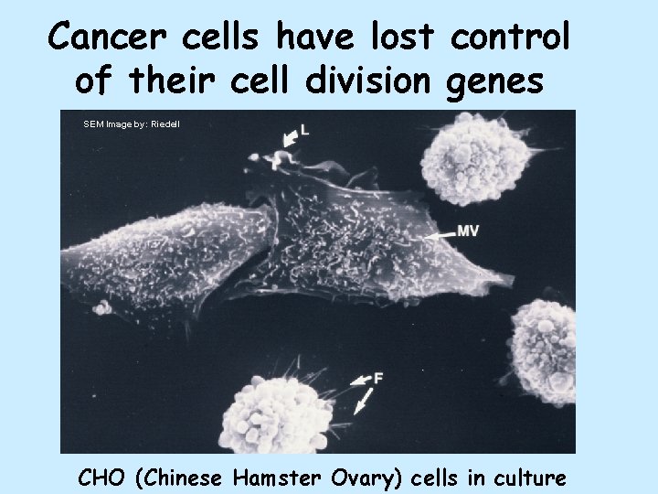 Cancer cells have lost control of their cell division genes SEM Image by: Riedell