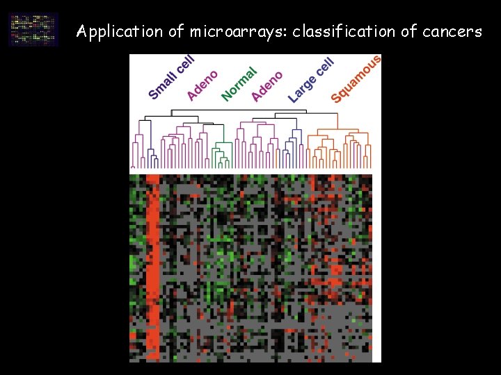Application of microarrays: classification of cancers Application of microarrays: classification of cancers