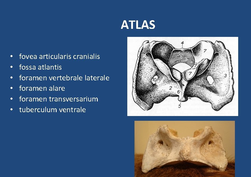 ATLAS • • • fovea articularis cranialis fossa atlantis foramen vertebrale laterale foramen alare