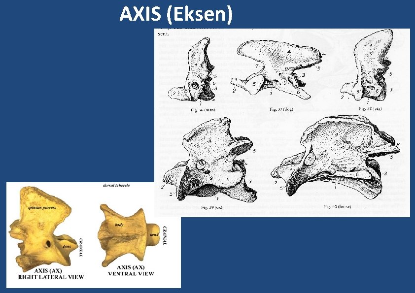 AXIS (Eksen) 